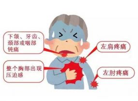 经常心绞痛怎么办 如何预防心绞痛的发生?