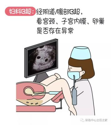妇科检查项目有哪些