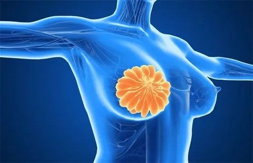 乳腺体检前注意事项