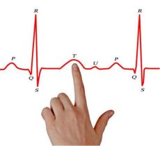 心电图的波型怎么看？