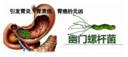 幽门螺杆菌能检查出哪些问题？