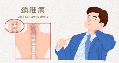 颈椎病需要做哪些检查？