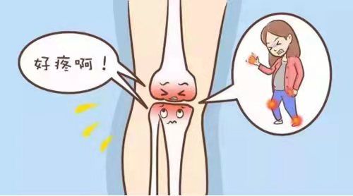 骨关节炎检查什么项目