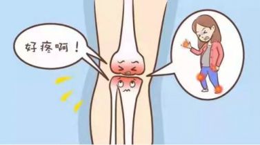 骨关节炎检查什么项目