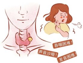 慢性咽炎需要做的检查项目有哪些？