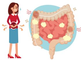 慢性肠炎的症状表现是什么 饮食方面需要注意什么