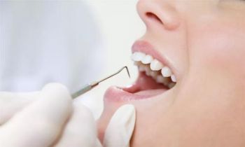 牙周炎的症状 牙周炎的检查项目
