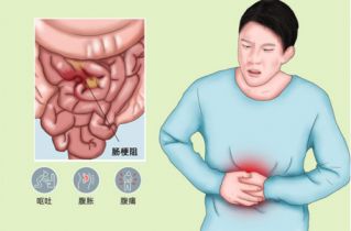 肠梗阻的主要症状表现是什么?