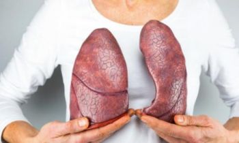 什么是肺癌 肺癌的早期表现