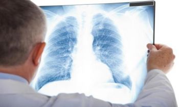 肺结核的危害有哪些？如何预防肺结核