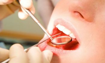 口腔溃疡是什么原因 口腔溃疡的治疗方法