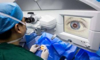 近视眼手术有哪几种 近视手术的注意事项