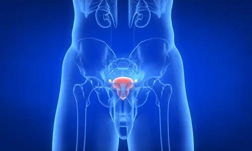 前列腺炎会影响生育吗？前列腺炎影响精子吗？