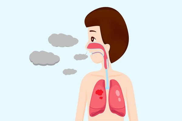 呼吸道感染怎么办？呼吸道感染该检查什么？