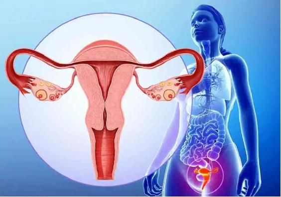 子宫肉瘤是什么？子宫肉瘤严重吗？如果发现了子宫肉瘤，又应该如何治疗呢？